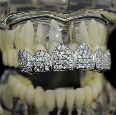Iced Out grill (11829519183)